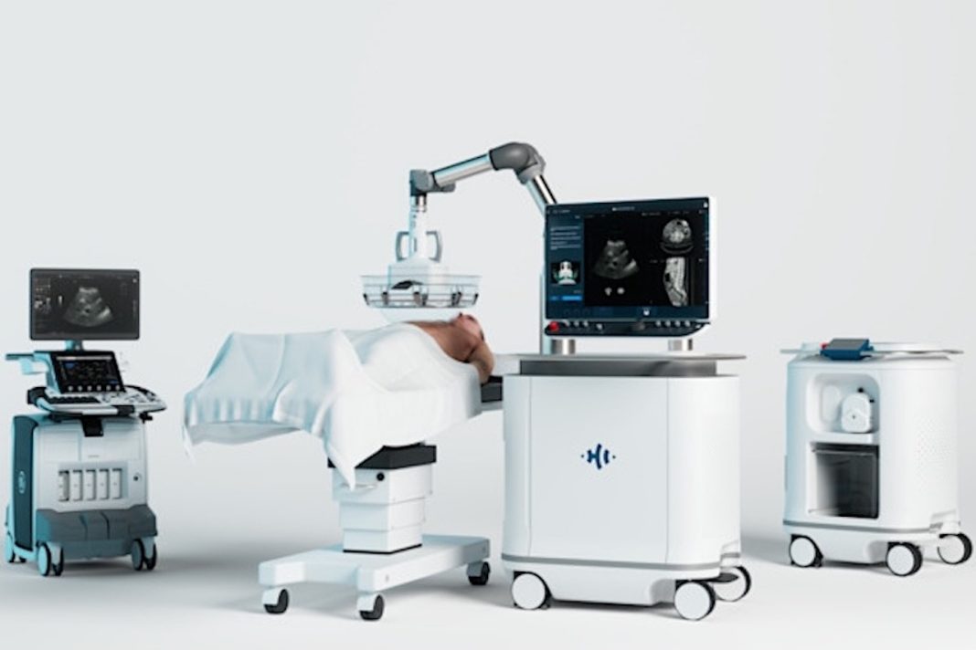 Ochsner Launches Noninvasive Liver Treatment